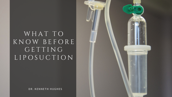What to Know Before Getting Liposuction